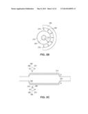 Biodegradable stent with enhanced fracture toughness diagram and image