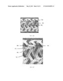 Biodegradable stent with enhanced fracture toughness diagram and image