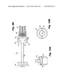 Recessed Groove for Better Suture Retention diagram and image