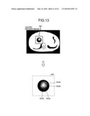 SYSTEM, APPARATUS, AND METHOD FOR IMAGE PROCESSING AND MEDICAL IMAGE     DIAGNOSIS APPARATUS diagram and image