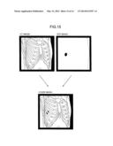 SYSTEM, APPARATUS, AND METHOD FOR IMAGE PROCESSING AND MEDICAL IMAGE     DIAGNOSIS APPARATUS diagram and image