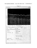 Methods, Systems and Computer Program Products for Processing Images     Generated Using Fourier Domain Optical Coherence Tomography (FDOCT) diagram and image