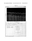 Methods, Systems and Computer Program Products for Processing Images     Generated Using Fourier Domain Optical Coherence Tomography (FDOCT) diagram and image