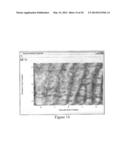 Methods, Systems and Computer Program Products for Processing Images     Generated Using Fourier Domain Optical Coherence Tomography (FDOCT) diagram and image