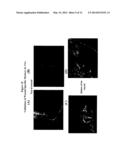 Methods and Compositions For Wound Treatment diagram and image