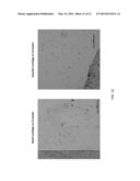 MINCED CARTILAGE SYSTEMS AND METHODS diagram and image