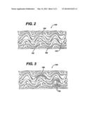 Drug/Drug Delivery Systems For The Prevention And Treatment Of Vascular     Disease diagram and image