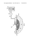 APPARATUSES, METHODS, AND COMPOSITIONS FOR THE TREATMENT AND PROPHYLAXIS     OF CHRONIC WOUNDS diagram and image