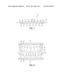 ARCH BARS FOR USE IN MAXILLOFACIAL SURGERY AND ORTHODONTICS diagram and image