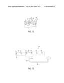 ARCH BARS FOR USE IN MAXILLOFACIAL SURGERY AND ORTHODONTICS diagram and image