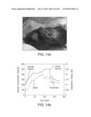 MEMS AFFINITY SENSOR FOR CONTINUOUS MONITORING OF ANALYTES diagram and image