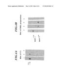 MASP-2, A COMPLEMENT FIXING ENZYME, AND USES FOR IT diagram and image