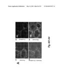 USE OF PERIOSTIN AS A NOVEL BIOMARKER diagram and image