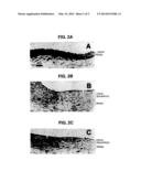 METHOD FOR TREATING ATHEROSCLEROSIS OR RESTENOSIS USING MICROTUBULE     STABILIZING AGENT diagram and image