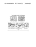 SUBSTITUTED CATHECHOLS AS INHIBITORS OF IL-4 AND IL-5 FOR THE TREATMENT     BRONCHIAL ASTHMA diagram and image