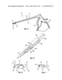 SURGICAL ACCESS SYSTEM AND RELATED METHODS diagram and image