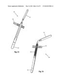 SURGICAL ACCESS SYSTEM AND RELATED METHODS diagram and image