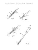 SURGICAL ACCESS SYSTEM AND RELATED METHODS diagram and image