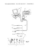 SURGICAL ACCESS SYSTEM AND RELATED METHODS diagram and image