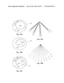 ULTRASOUND DEVICES METHODS AND SYSTEMS diagram and image