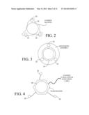 Monitoring Physiological Signals During External Electrical Stimulation diagram and image