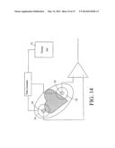 Monitoring Physiological Signals During External Electrical Stimulation diagram and image