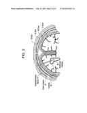 System for Transcutaneous Monitoring of Intracranial Pressure diagram and image