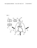 CARDIO-PULMONARY RESUSCITATION AIRWAY VALVE AND DEVICES diagram and image