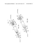 CATHETER WITH IMPROVED TORQUE TRANSMISSION diagram and image