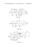 CATHETER WITH IMPROVED TORQUE TRANSMISSION diagram and image