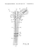 INTRAMEDULLARY NAIL diagram and image