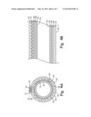 GUIDE CATHETER OCCLUSION BALLOON WITH ACTIVE INFLATION diagram and image