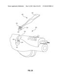 TISSUE FIXATION ASSEMBLY HAVING PREPOSITIONED FASTENERS AND METHOD diagram and image