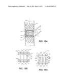 Embolism Deflector diagram and image