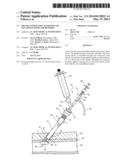 SHEATH AND BALLOON TENSIONER AND LOCATOR SYSTEMS AND METHODS diagram and image