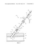 SHEATH AND BALLOON TENSIONER AND LOCATOR SYSTEMS AND METHODS diagram and image