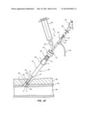 SHEATH AND BALLOON TENSIONER AND LOCATOR SYSTEMS AND METHODS diagram and image