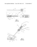 PROCEDURAL SHEATH ADAPTER FOR VASCULAR CLOSURE DEVICE diagram and image