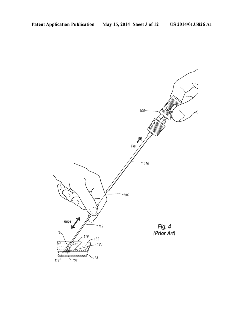 PROCEDURAL SHEATH ADAPTER FOR VASCULAR CLOSURE DEVICE - diagram, schematic, and image 04