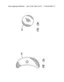 MULTI-LAYER BRAIDED STRUCTURES FOR OCCLUDING VASCULAR DEFECTS diagram and image