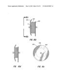 MULTI-LAYER BRAIDED STRUCTURES FOR OCCLUDING VASCULAR DEFECTS diagram and image