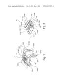 Multi-Directional Thorax Wall Stabilisation diagram and image