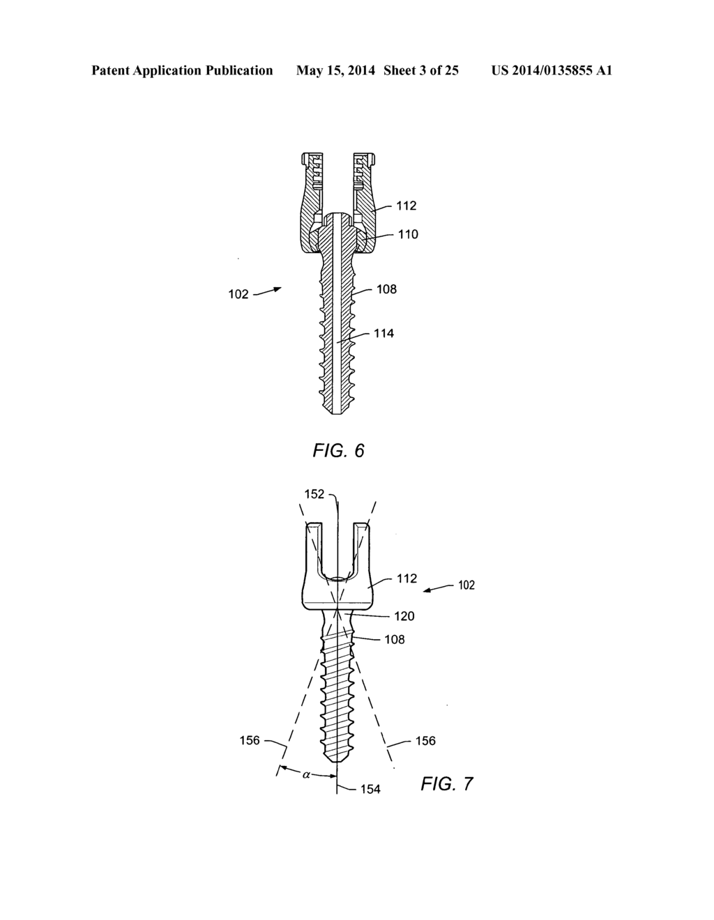 INSTRUMENTS AND METHODS FOR ADJUSTING SEPARATION DISTANCE OF VERTEBRAL     BODIES WITH A MINIMALLY INVASIVE SPINAL STABILIZATION PROCEDURE - diagram, schematic, and image 04