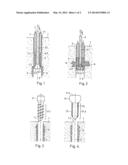 METHOD OF ANCHORING AN IMPLANT IN TISSUE diagram and image