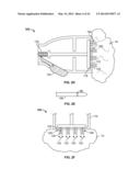 METHODS AND DEVICES FOR TREATING TISSUE diagram and image