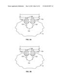 METHODS AND DEVICES FOR TREATING TISSUE diagram and image