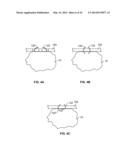 METHODS AND DEVICES FOR TREATING TISSUE diagram and image