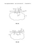 METHODS AND DEVICES FOR TREATING TISSUE diagram and image