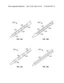 METHODS AND DEVICES FOR TREATING TISSUE diagram and image