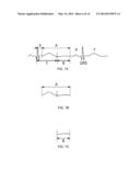 Method and apparatus for measuring and treating shivering during     therapeutic temperature control diagram and image